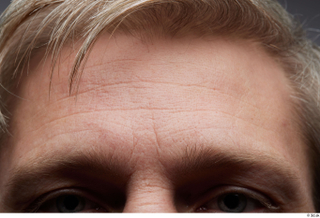 HD Face Skin Chase eyebrow face forehead hair skin pores…